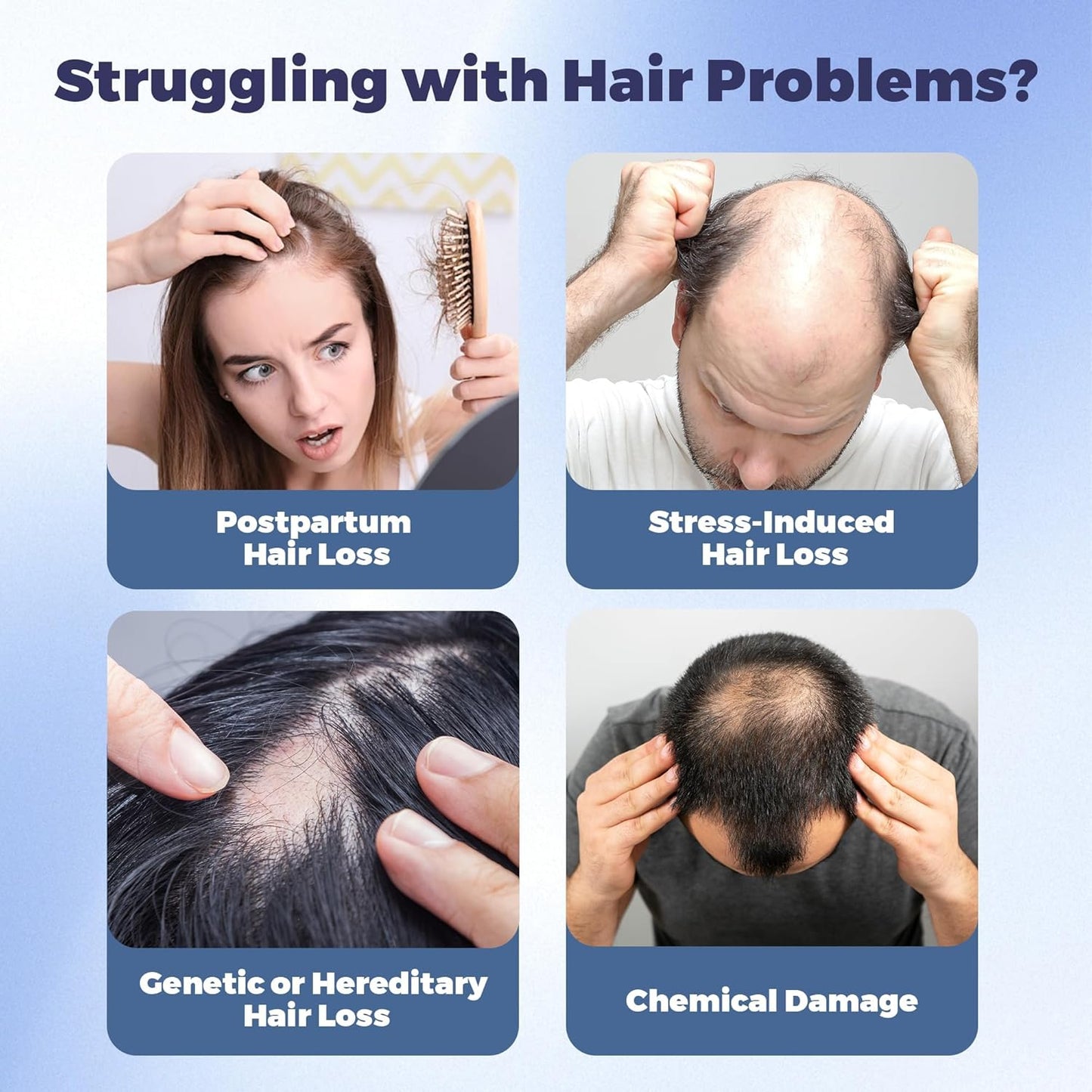 Rosemary Hair Growth Serum Roll-On – Scalp Strengthening & Thickening Treatment (25 mL)