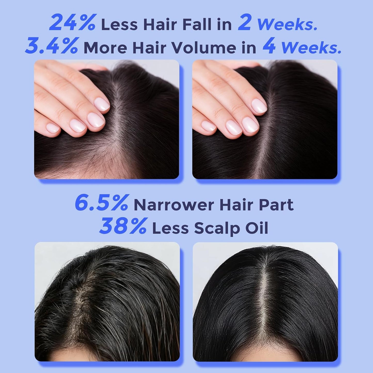 Rosemary Hair Growth Serum Roll-On – Scalp Strengthening & Thickening Treatment (25 mL)
